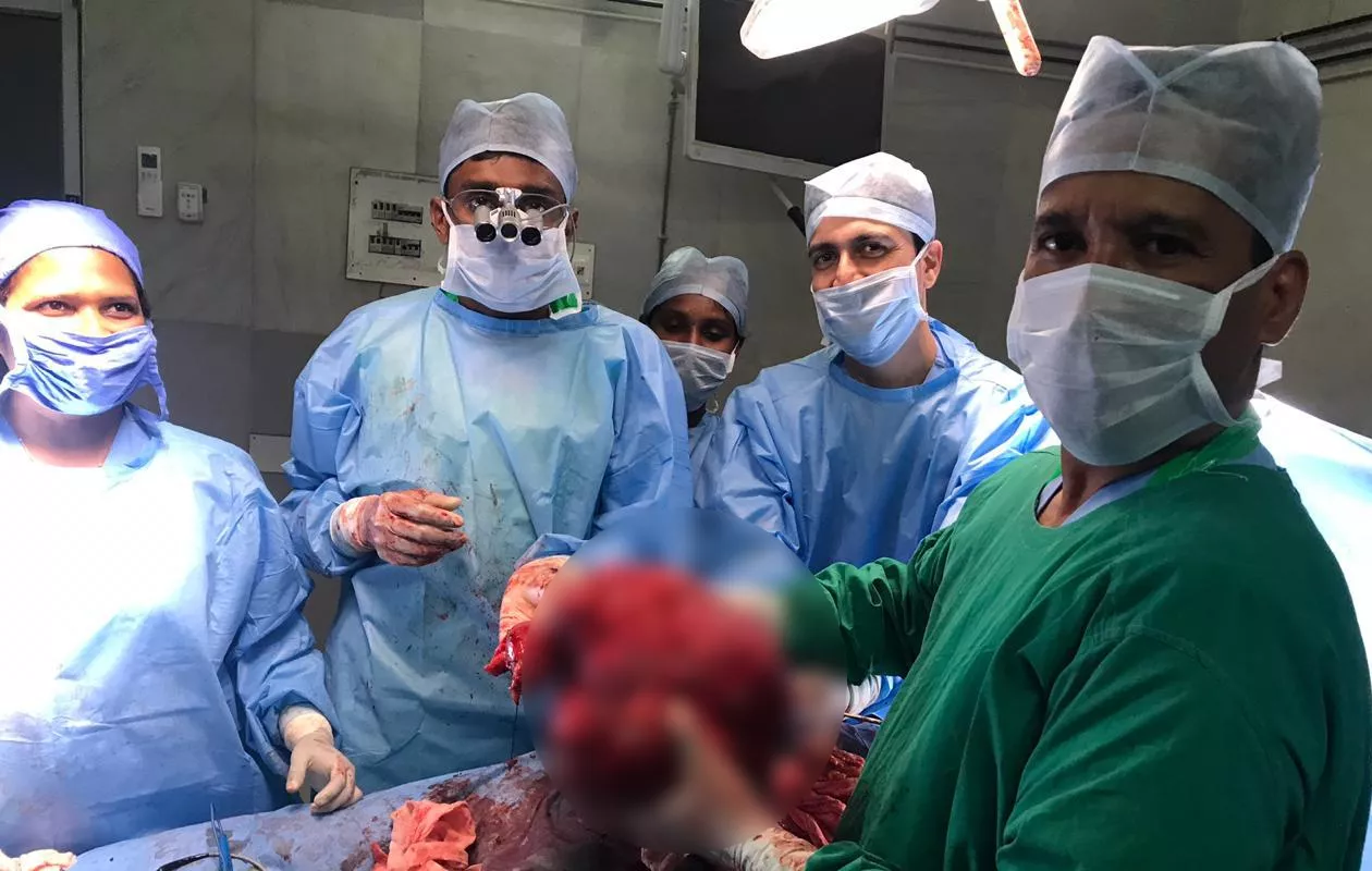 LARGEST  RETROPERITONEAL TUMOUR REMOVED BY SURGERY