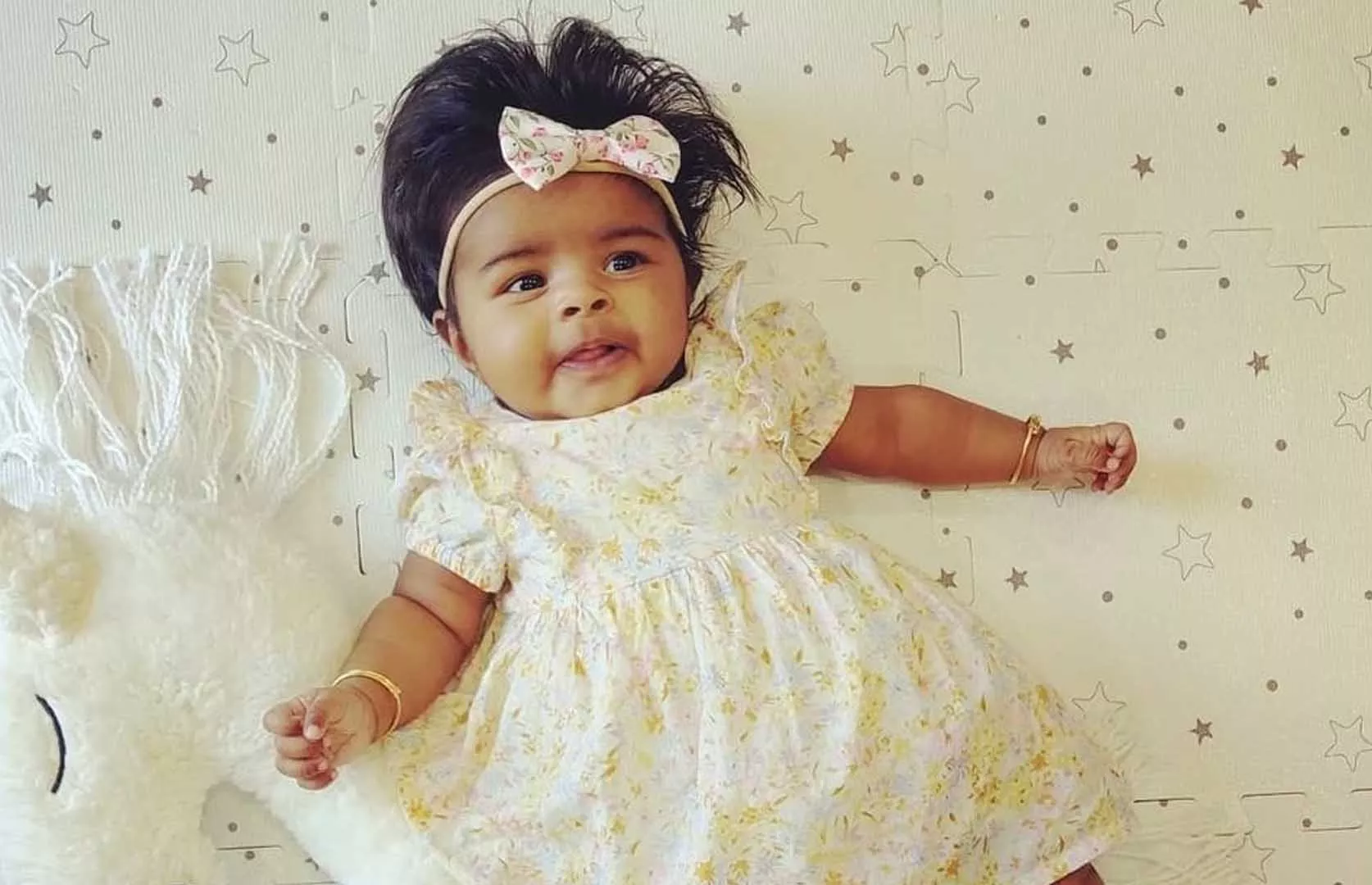 LONGEST CONGENITAL HAIR OF AN INFANT BABY GIRL