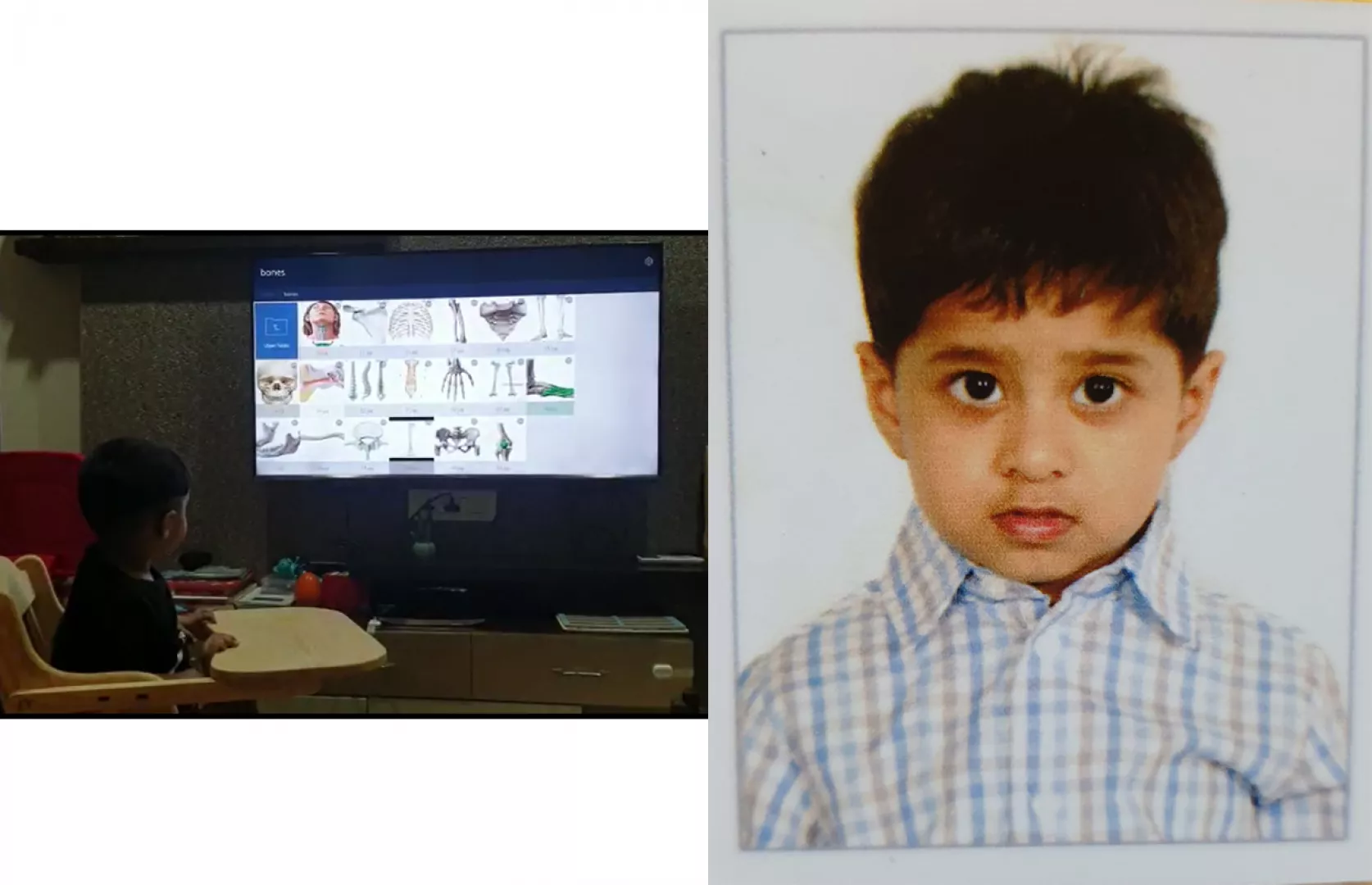 MAXIMUM NUMBER OF BONES OF HUMAN BODY IDENTIFIED AND RECITED BY A TODDLER